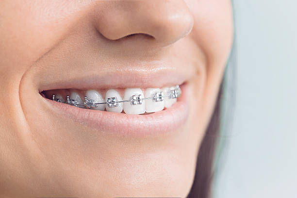 Best Wisdom Tooth Removal  in Pisgah, AL